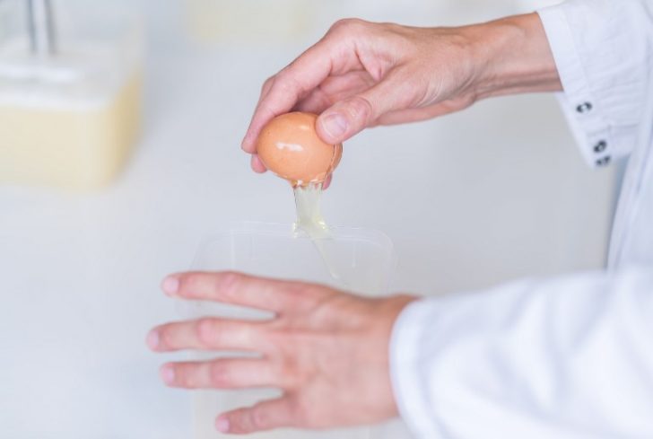 GERMANY-NETHERLANDS-HEALTH-FARM-FOOD