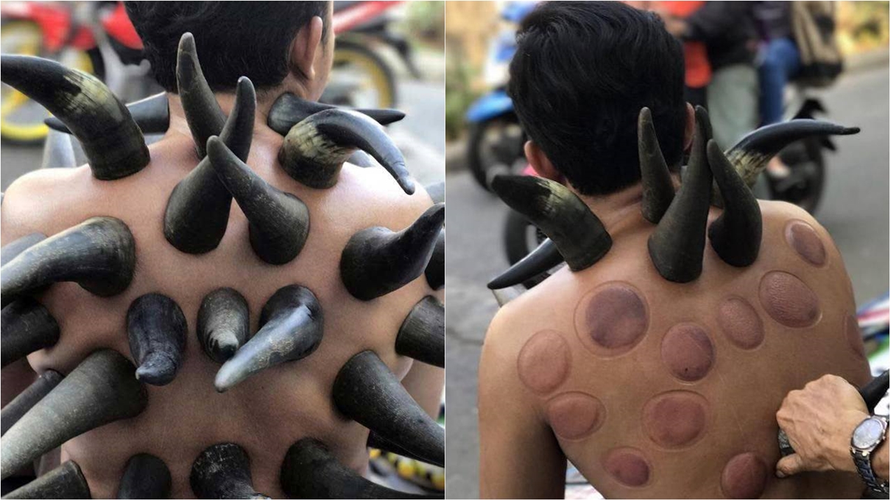 แบบนี้ก็มีด้วย?! “เขาควายครอบบำบัดโรค” ในอินโดฯ ชี้เพิ่มการไหลเวียนโลหิต-แก้ปวดเมื่อย
