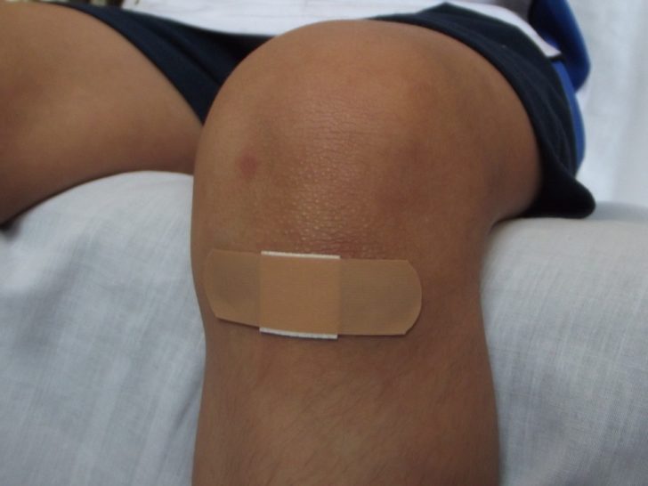 wound-106374_960_720 จริงหรือ! เป็นแผลตอนกลางวัน หายเร็วกว่าเป็นแผลกลางคืน