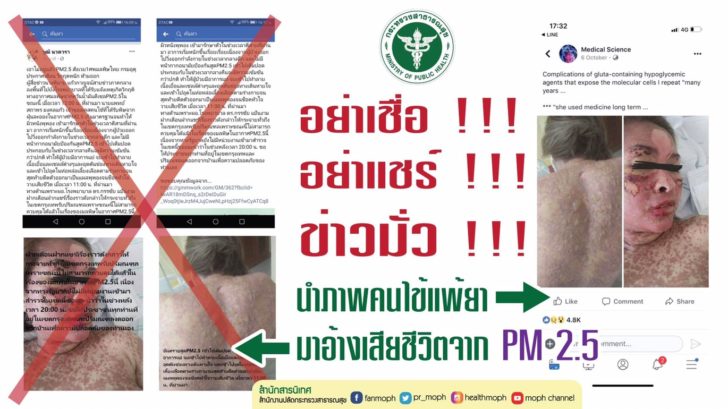 หยุดแชร์ข่าวมั่ว! สธ. เบรคกระแสดราม่า เตือนภาพคนไข้แพ้ยา ไม่ใช่มาจากฝุ่น 2.5 ไมครอน
