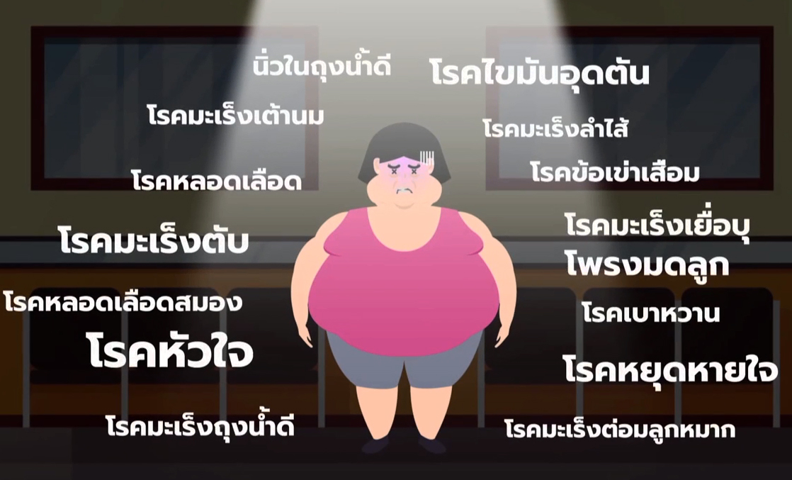 แก้วิกฤตคนอ้วนด้วยการผ่าตัด ควบคุมโรคได้มากกว่าผู้ไม่ผ่าตัดเกือบ 5 เท่า