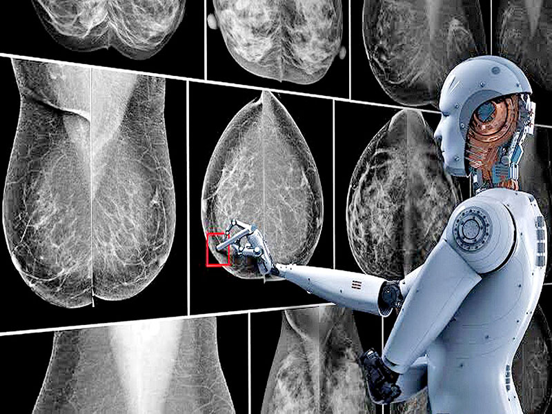 ยกระดับการคัดกรองมะเร็งเต้านม ด้วยงานวิจัย AI Mammogram