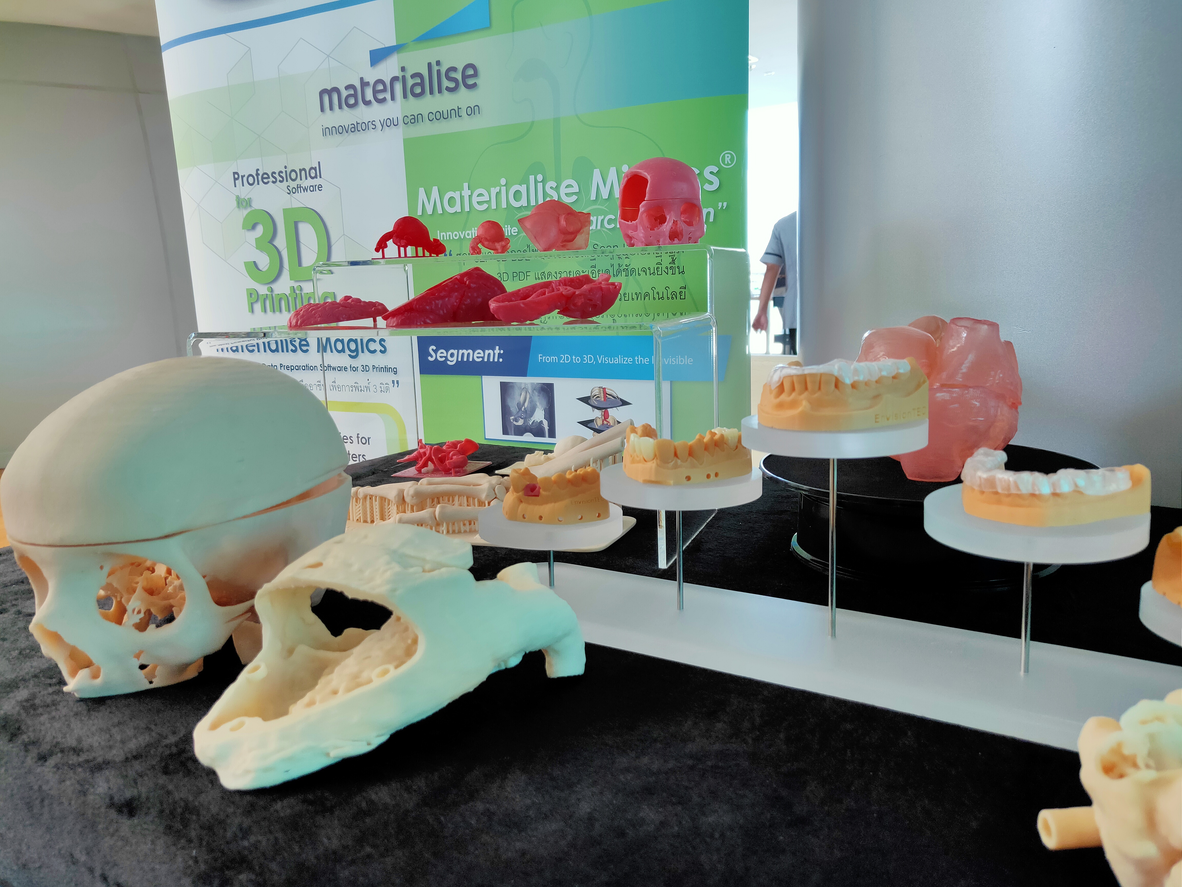 3D printing Med เทคโนโลยีไม่ไกลเกินเอื้อม