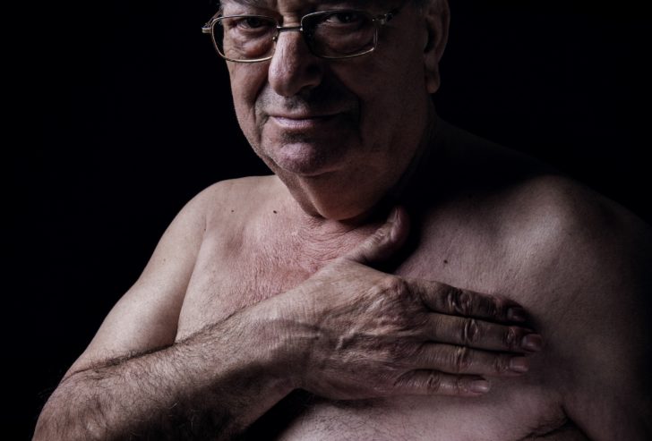 Mastectomised Patients Pose For Pictures To Raise Awareness Of Breast Cancer