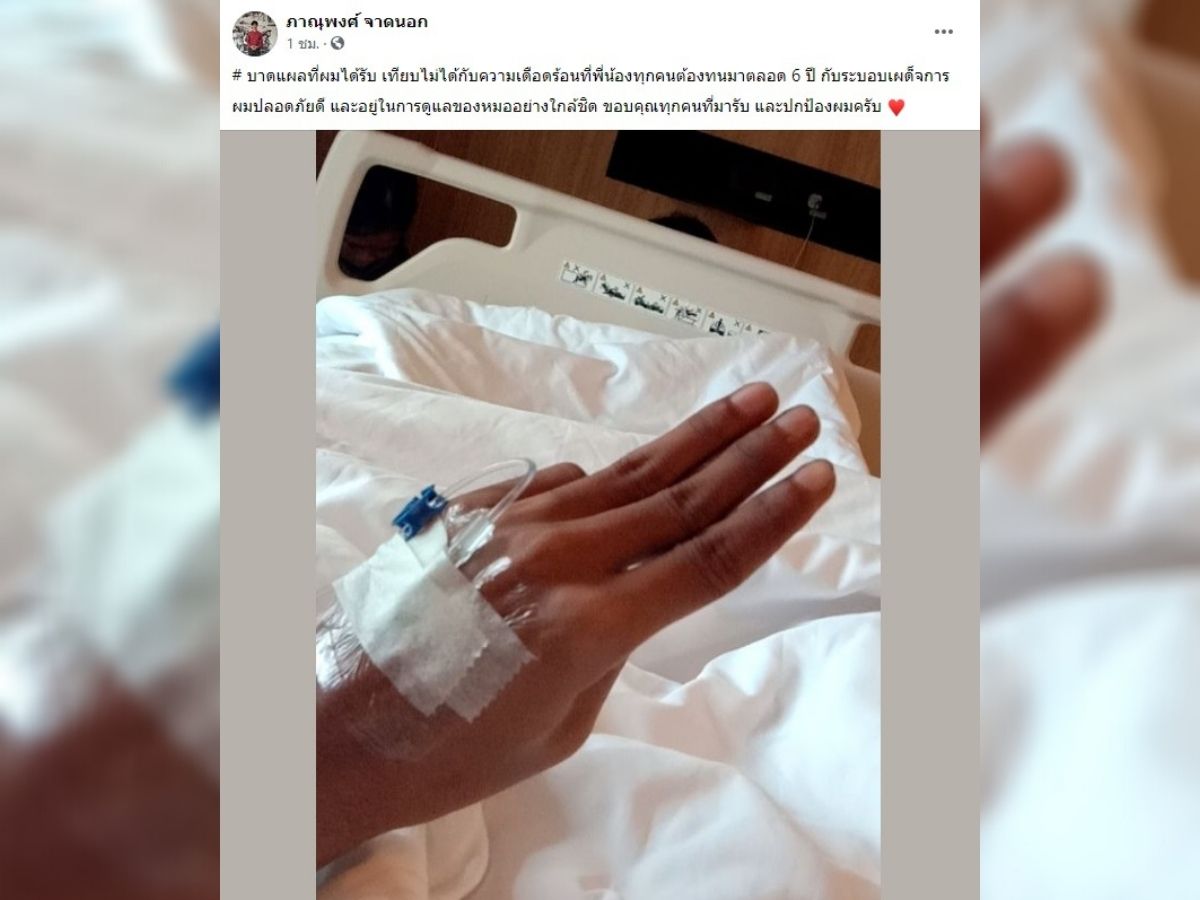 ไมค์ โพสต์ บาดแผลวันนี้ เทียบไม่ได้กับ 6 ปี ใต้ระบอบเผด็จการ