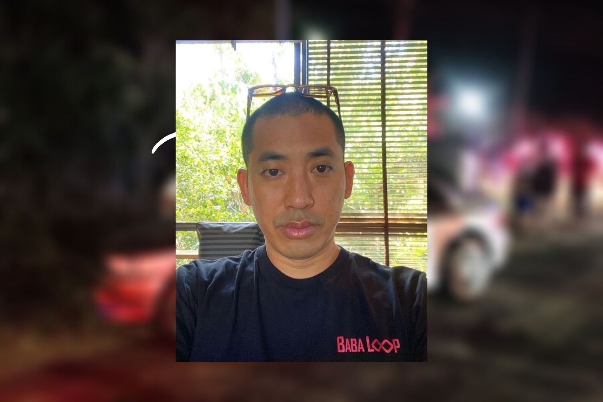 ปลาวาฬ ศรีพันวา ยังอยู่ ICU เผยอาการล่าสุด หลังประสบอุบัติเหตุ