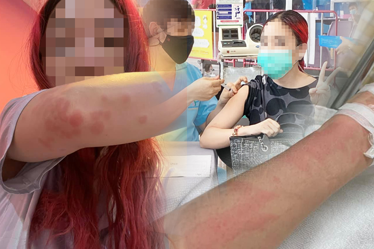 สาวเล่าอาการแพ้ หลังฉีดซิโนแวก ถ้าเลือกได้ ขอที่มีประสิทธิภาพกว่านี้