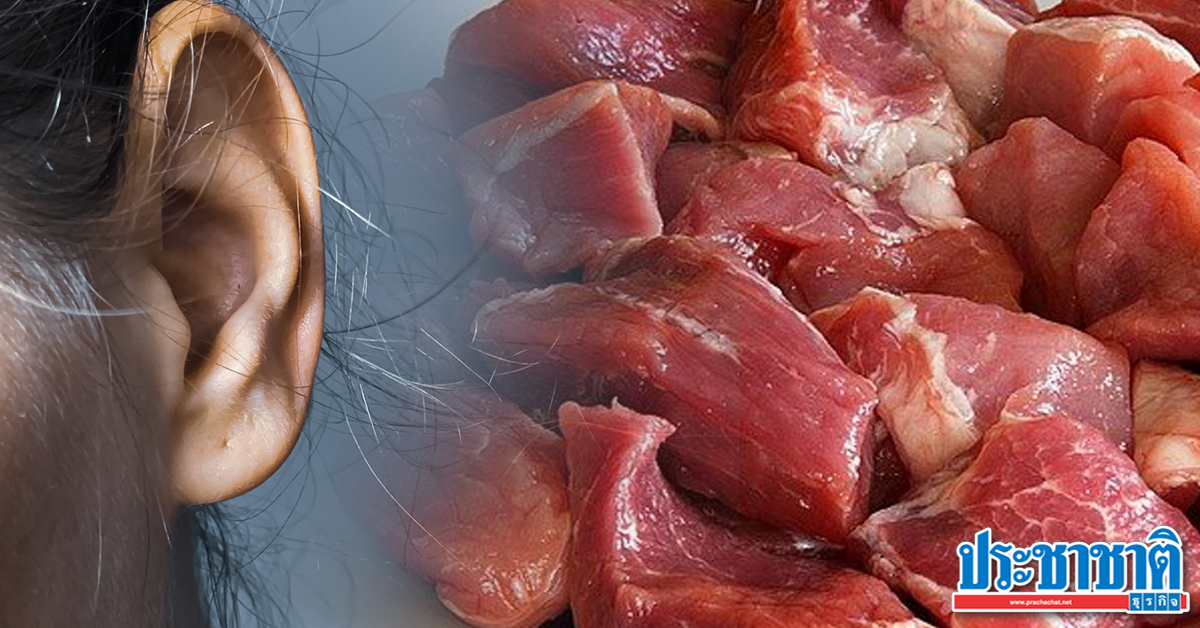 โรคหูดับ หมูดิบ : à¸ªà¸ à¸« à¸§à¸à¸à¸à¹à¸à¸¢à¸à¸¥à¸­à¸à¸ à¹à¸«à¸¡ à¸­à¸¢ à¸²à¸ à¸à¸«à¸¡ à¸ à¸ à¹à¸ª à¸¢à¸à¹à¸£à¸à¹à¸ à¸« à¸ à¸ à¸«à¸ à¸à¸ª à¸à¸ à¸à¸à¸²à¸¢ / อาการของโรคไข้หูดับหรือโรคติดเชื้อแบคทีเรีย สเตรฟโตคอกคัส ซูอิส (streptococcus suis)จะมีอาการปวดศีรษะ อาเจียน หูดับ การรักษาโรคหูดับจะให้ยาฉีด