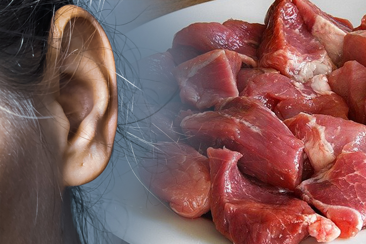 รู้จัก “โรคไข้หูดับ” กินเนื้อหมู กึ่งสุกกึ่งดิบ อันตรายถึงชีวิต