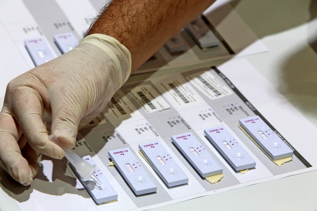 สธ. เตรียมใช้ Rapid Antigen Test ตรวจโควิดในสถานพยาบาล