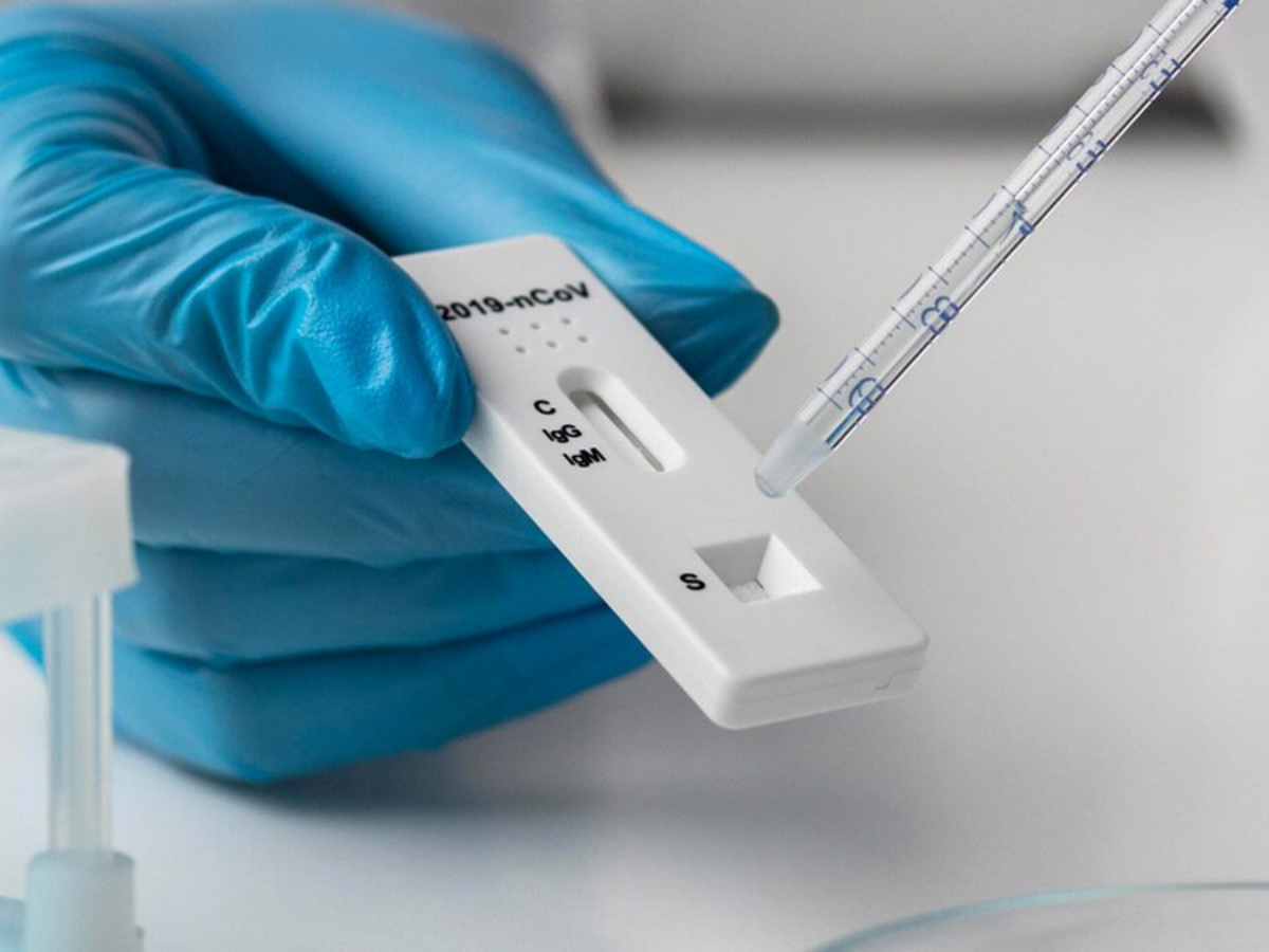 Тест rt. Covid antigen rapid test. Тест rt. Rapid test covid отрицательный. Экспресс тест на антитела по крови из пальца.