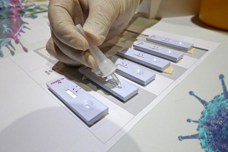 antigen antigen