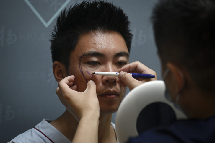 CHINA-SOCIAL-SURGERY-GENDER