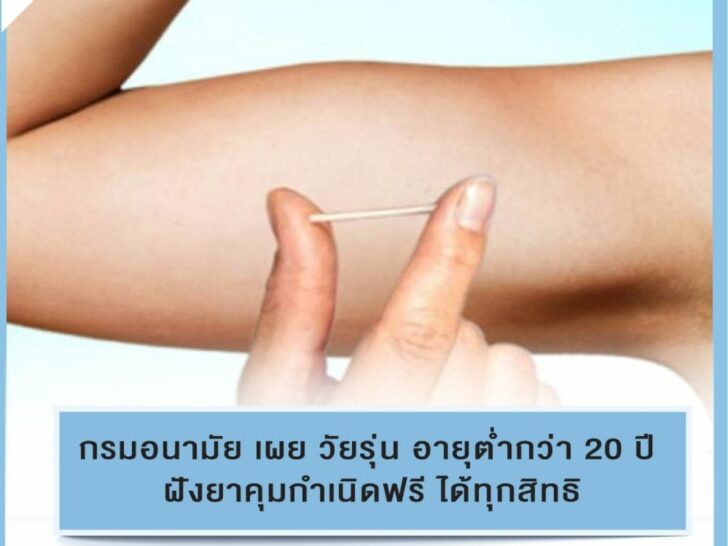 วัยรุ่นอายุไม่ถึง 20 ฝังคุมกำเนิดฟรี