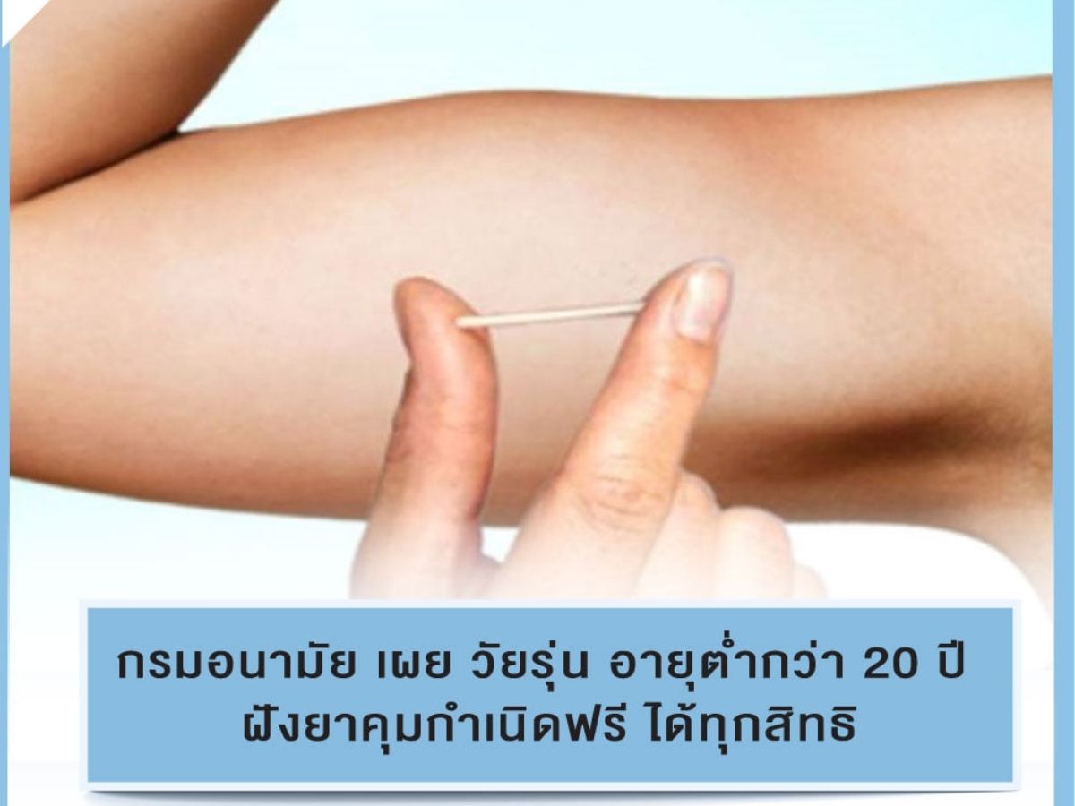 วัยรุ่นอายุไม่ถึง 20 ปี ฝังยาคุมกำเนิด-ห่วงอนามัย ไม่เสียค่าใช้จ่าย