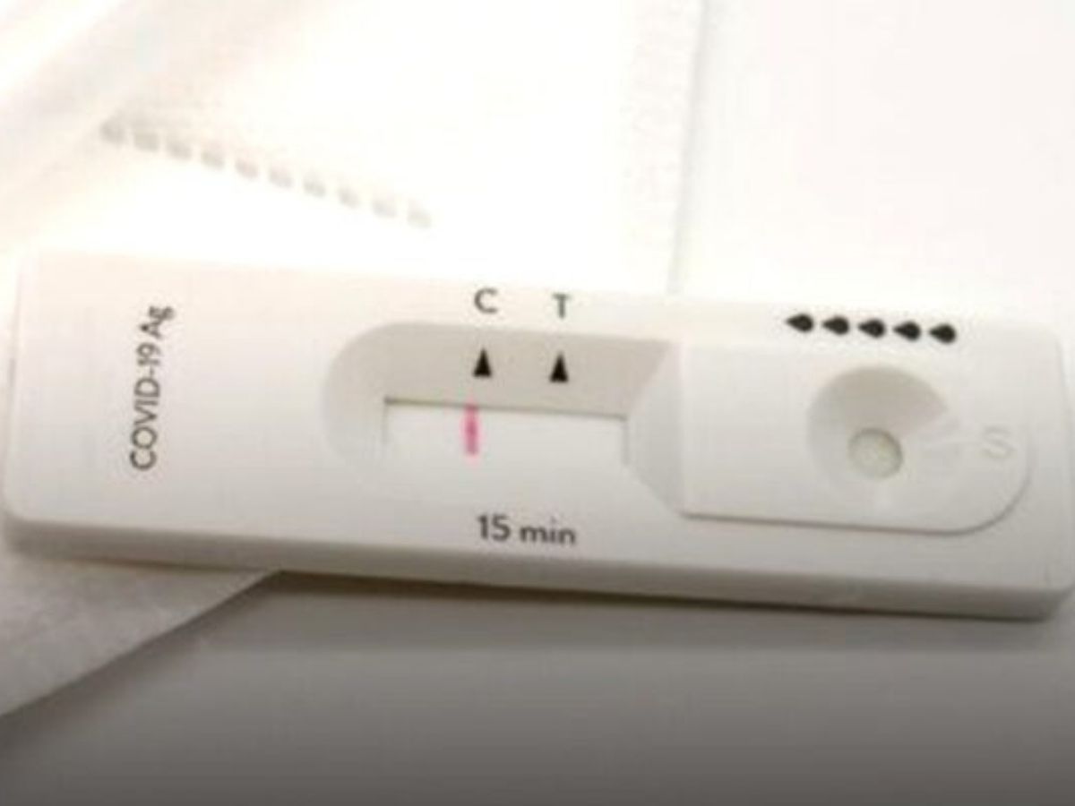 ผู้ประกันตน สงสัยว่าตัวเองติดโควิดต้องทำอย่างไร