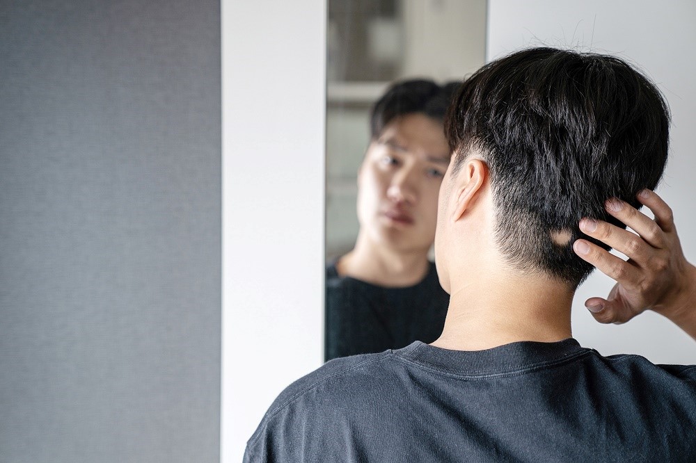 เยียวยาตัวเองอย่างไร ในวันที่คุณ…เริ่มขาดผม