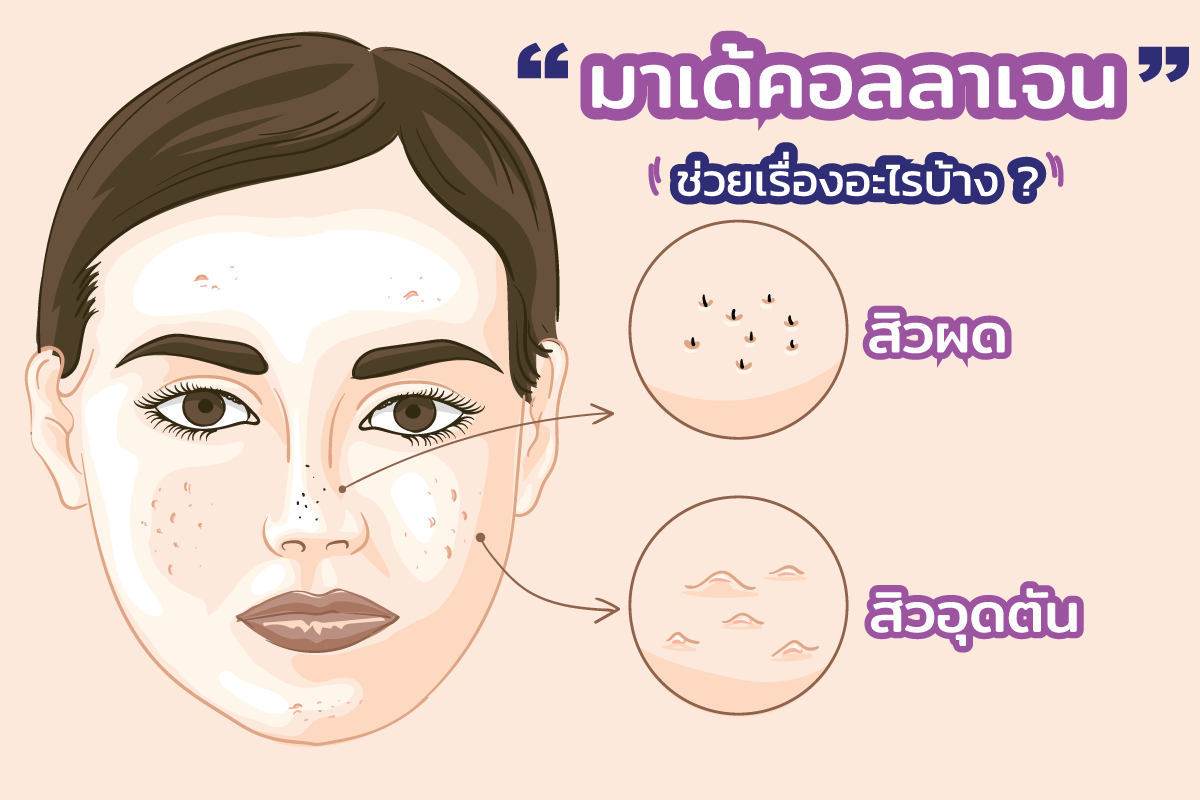 โปรแกรมมาเด้คอลลาเจน ช่วยแก้ปัญหาปรับผิวหน้าเรื่องอะไรบ้าง เห็นผลจริงไหม ใครบ้างควรฉีด
