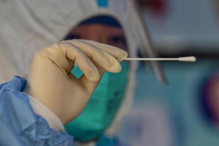 CHINA-HEALTH-VIRUS ตรวจโควิด-ตรวจ ATK