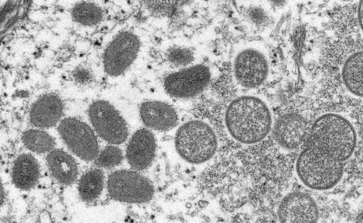DRC-WHO-HEALTH-VIRUS-MONKEYPOX ฝีดาษลิง
