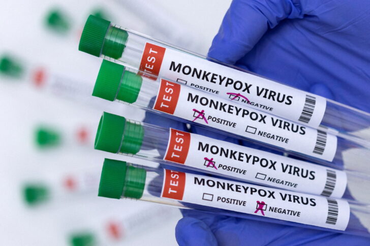 FILE PHOTO: Illustration shows test tubes labelled WHO เผยระดับความเสี่ยงฝีดาษลิงต่อสาธารณสุขทั่วโลก