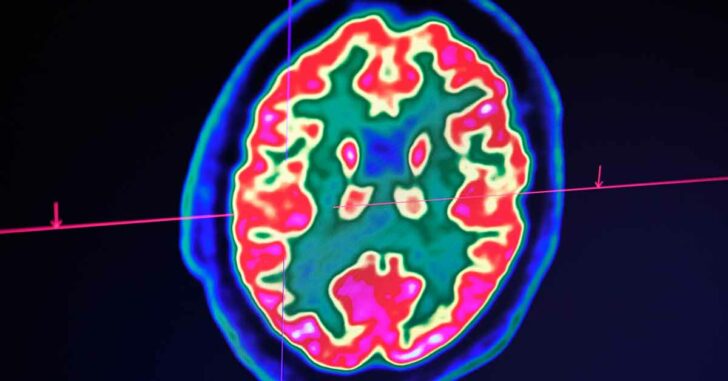 brain3