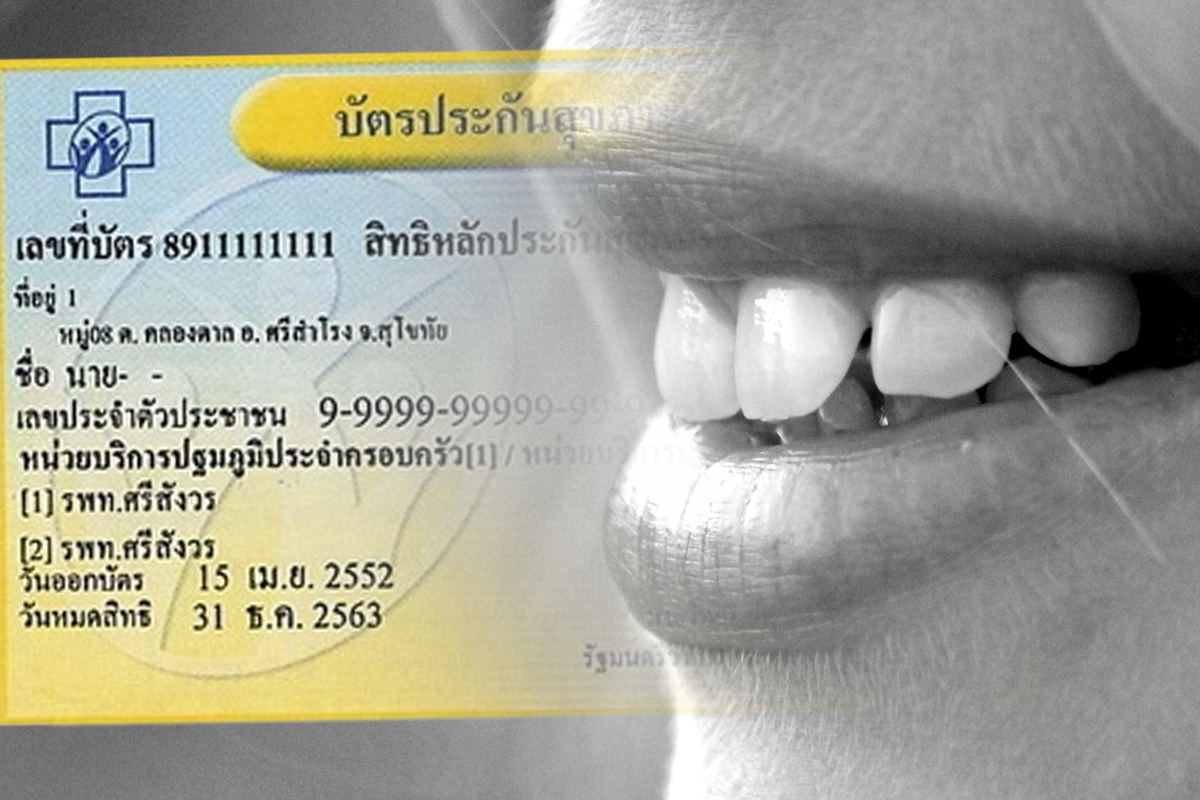 ทำฟัน “บัตรทอง บัตร 30 บาท” ใช้สิทธิกรณีใดบ้าง