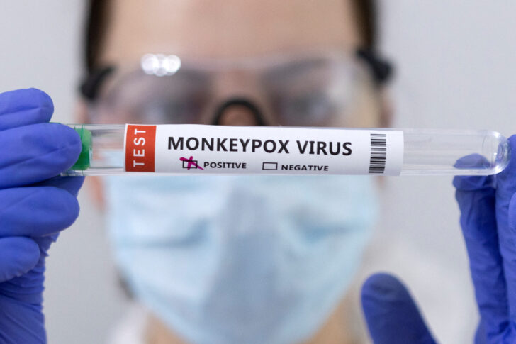FILE PHOTO: Illustration shows test tubes labelled ฟิลิปปินส์พบผู้ป่วยฝีดาษลิงรายแรก สัมผัสใกล้ชิด 10 ราย