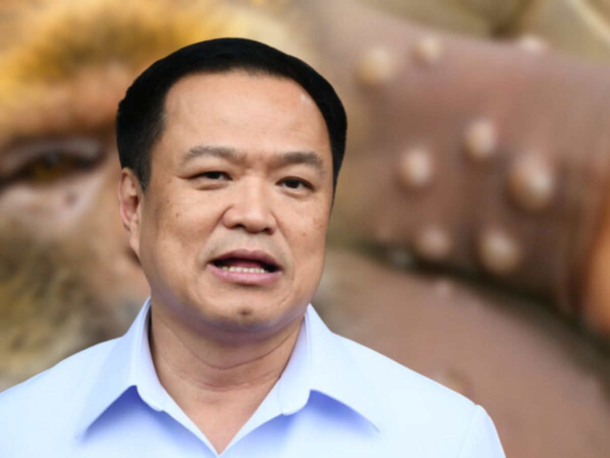 พบฝีดาษลิงรายที่ 2 ในกรุงเทพฯ “อนุทิน” ยืนยัน