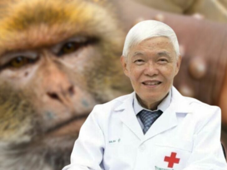 หมอยง เผยจุดต่างฝีดาษลิงในผู้ป่วยในและนอกแอฟริกา