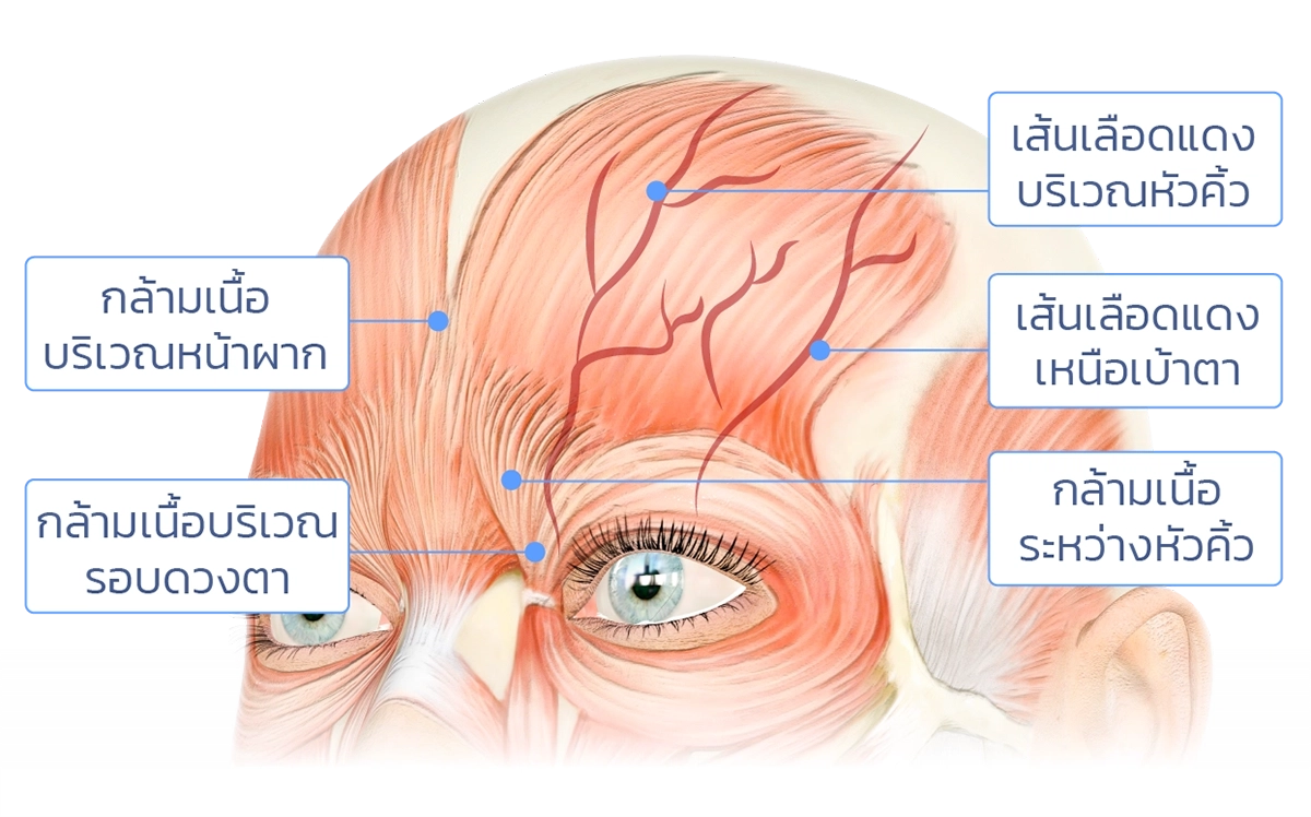 ฉีดฟิลเลอร์หน้าผาก อันตรายไหม