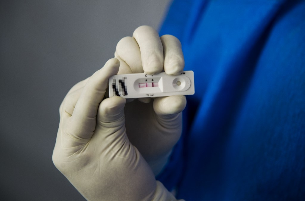 ผู้ประกันตน ม.33, ม.39 ติดโควิดต้องทำอย่างไร ?