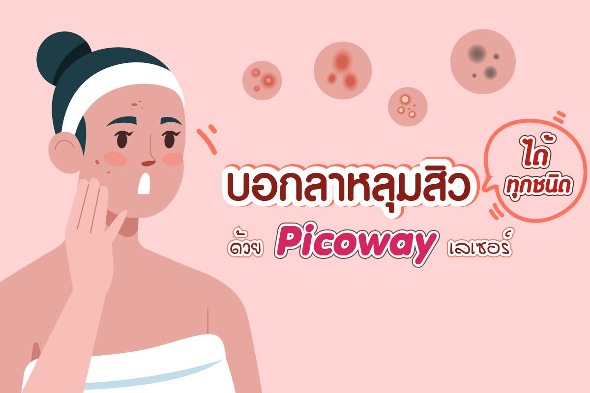 บอกลาหลุมสิวได้ทุกชนิดด้วย Picoway เลเซอร์คืออะไร ? รักษาหลุมสิวได้จริงไหม ?