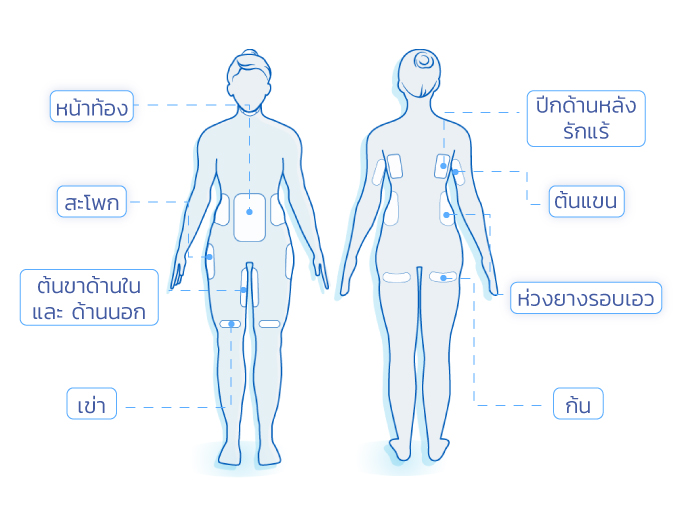 ส่วนที่เหมาะกับการทำ Coolsculpting ส่วนที่เหมาะกับการทำ Coolsculpting