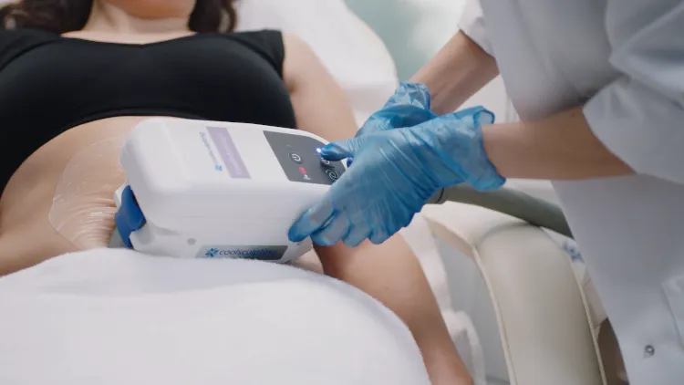 เทคโนโลยี CoolSculpting เทคโนโลยี CoolSculpting