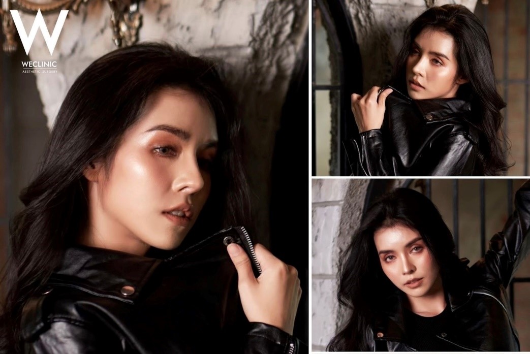 เสริมจมูก แก้จมูกอย่างไรให้เข้ากับใบหน้า ทรงจมูกสวยเป็นธรรมชาติแบบไหนนิยม