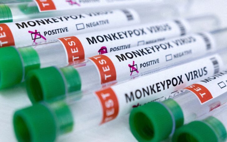 monkeypox สหรัฐพบผู้ติดเชื้อจากฝีดาษลิงเสียชีวิต