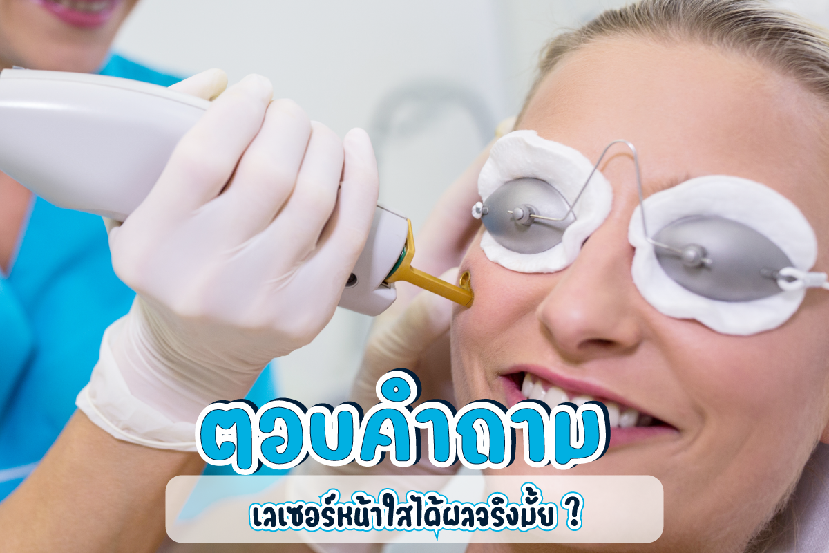 ตอบคำถามเลเซอร์หน้าใสได้ผลจริงไหม?