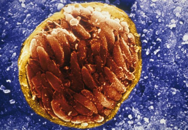 ภาพขยายเชื้อปรสิต Toxoplasma gondii ซึ่งอยู่ภายในซีสต์ที่สมองของหนูทดลอง