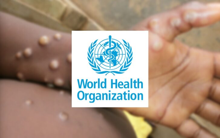 mpox who mpox who องค์การอนามัยโลก ฝีดาษลิง