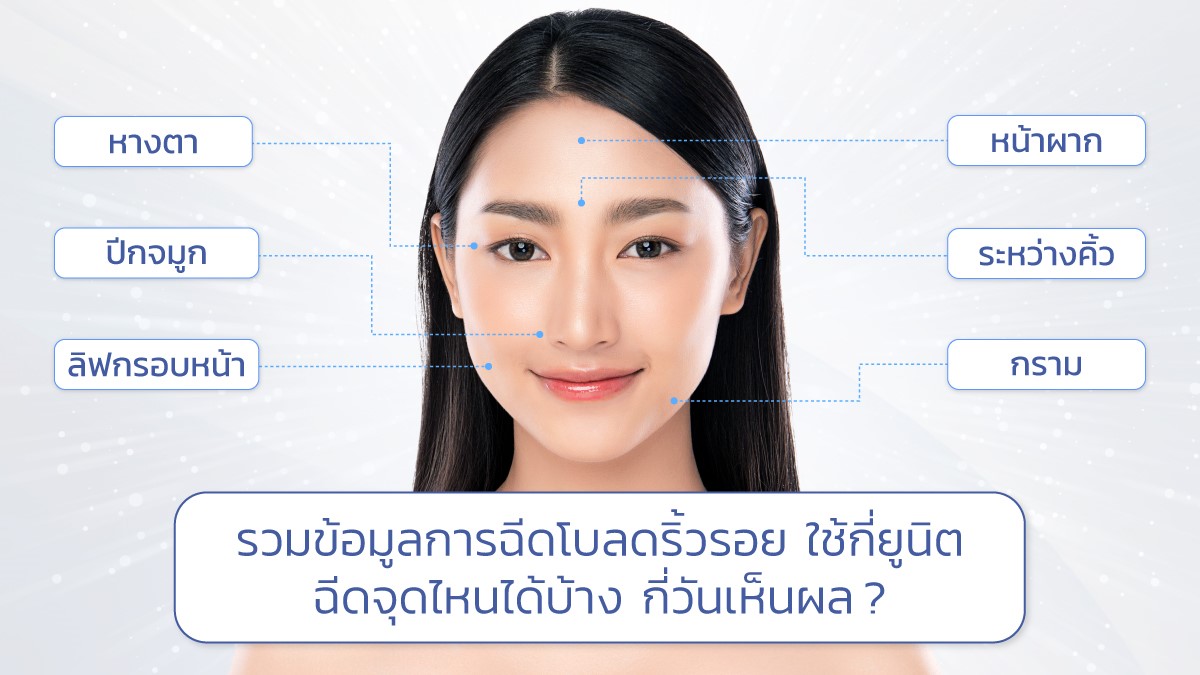 รวมข้อมูลการฉีดโบลดริ้วรอย ใช้กี่ยูนิต ฉีดจุดไหนได้บ้าง กี่วันเห็นผล ?
