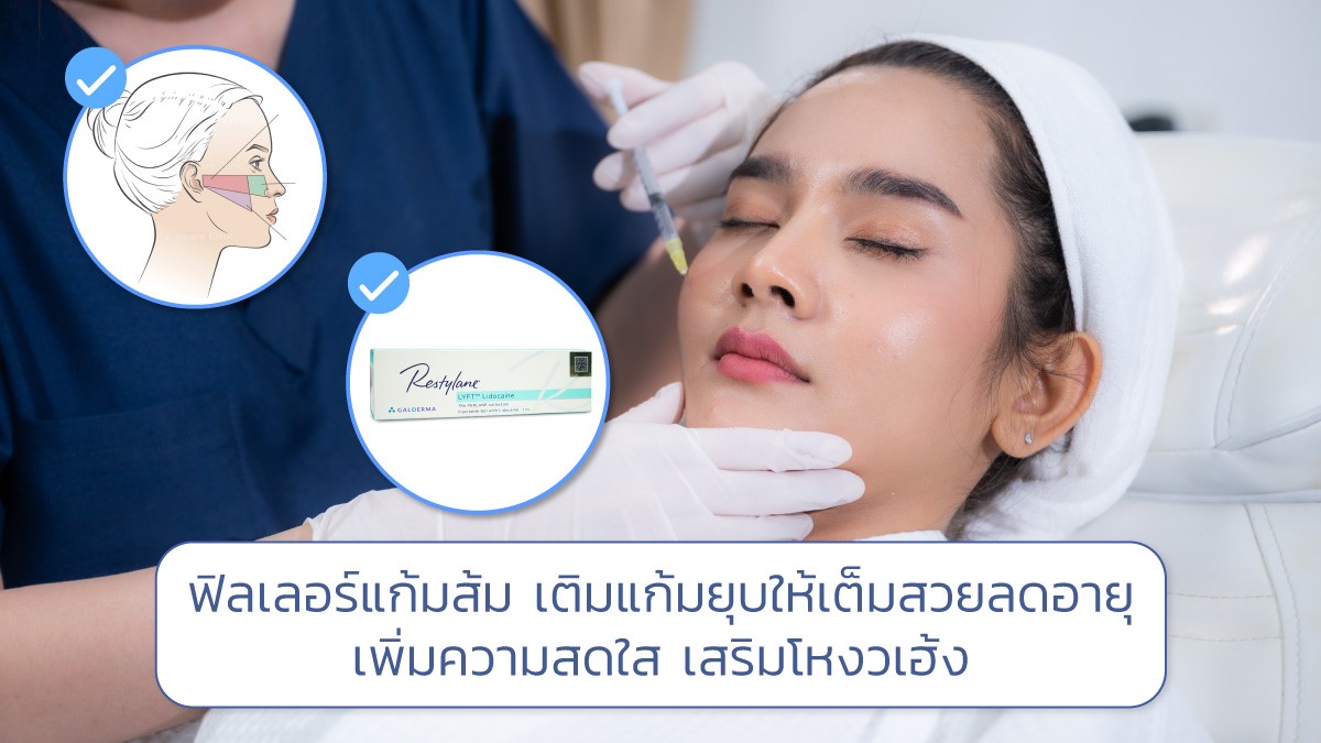 ฟิลเลอร์แก้มส้ม เติมแก้มยุบให้เต็มสวย ลดอายุ เพิ่มความสดใส เสริมโหงวเฮ้ง