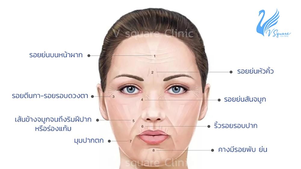 ริ้วรอยบนใบหน้า ริ้วรอยบนใบหน้า