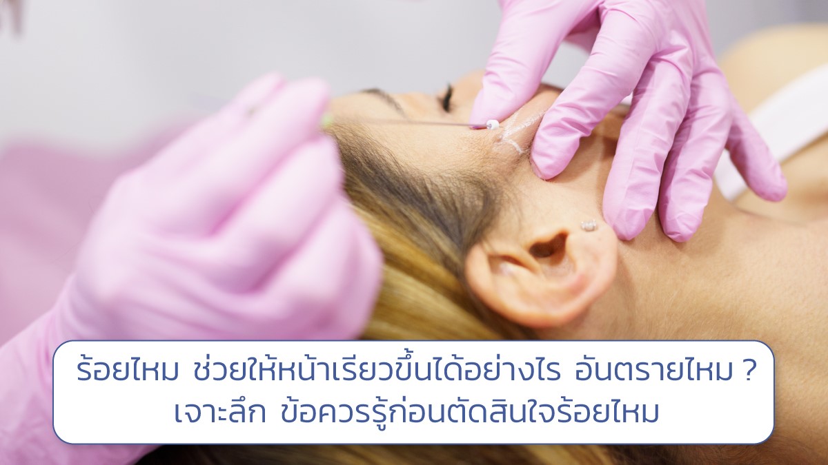 ร้อยไหม ช่วยให้หน้าเรียวขึ้นได้อย่างไร อันตรายไหม ? เจาะลึก ข้อควรรู้ก่อนตัดสินใจร้อยไหม