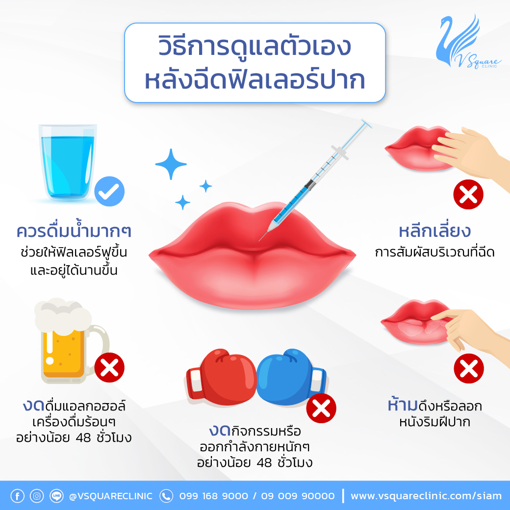 วิธีดูแลหลังฉีดฟิลเลอร์ปากกระจับ วิธีดูแลหลังฉีดฟิลเลอร์ปากกระจับ