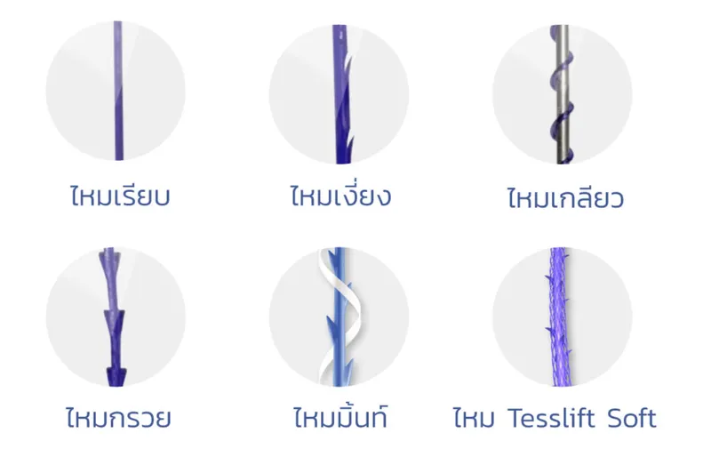 ไหมละลายแบ่งตามลักษณะของเส้นไหม ไหมละลายแบ่งตามลักษณะของเส้นไหม