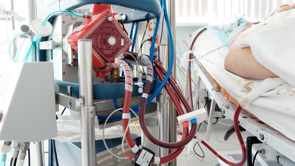 เอคโม่ (ECMO) “ปอดเทียม หัวใจเทียม” พยุงชีพผู้ป่วยวิกฤต