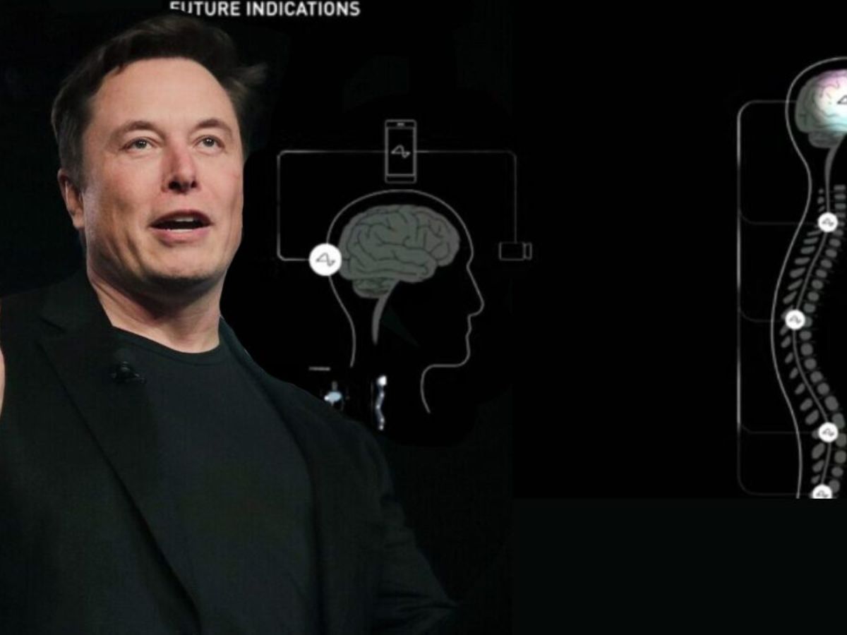 อีลอน มัสก์ เตรียมทดลองฝังชิป Neuralink ในสมองตัวเอง