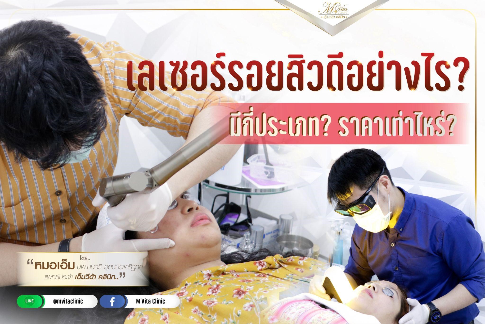 เลเซอร์