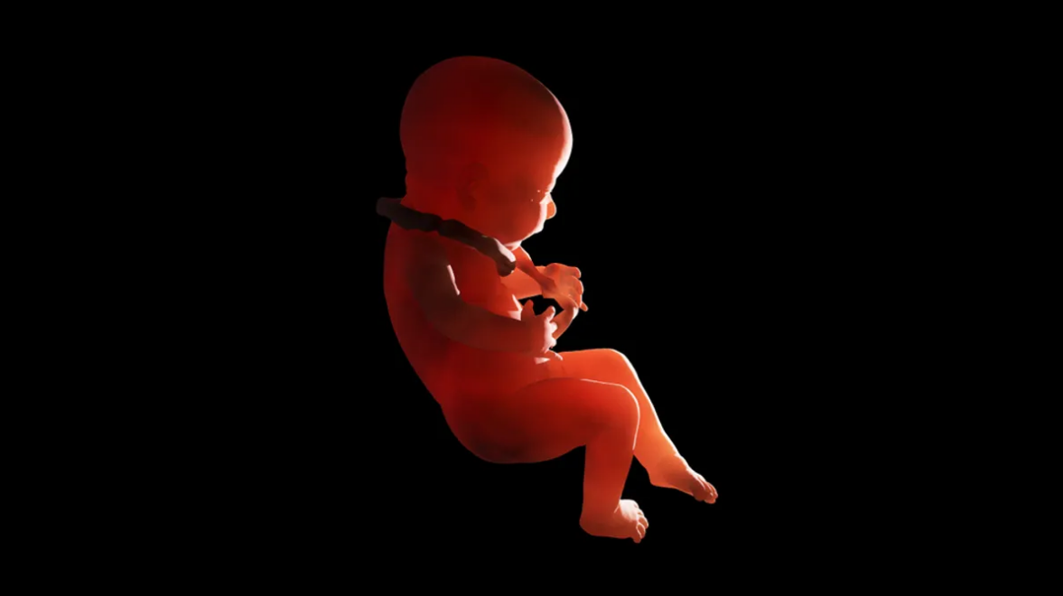 (รูปประกอบจากแฟ้มภาพ) แฝดปรสิตที่พบมีรูปร่างคล้ายตัวอ่อนระยะแรกในครรภ์มารดา